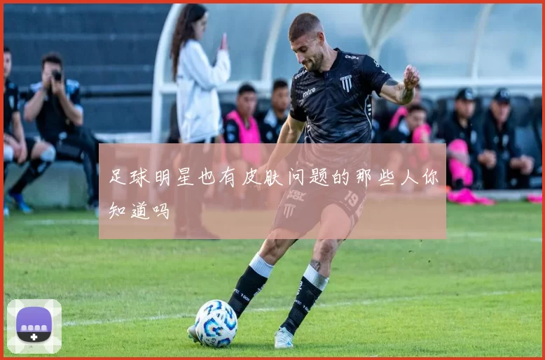 足球明星也有皮肤问题的那些人你知道吗